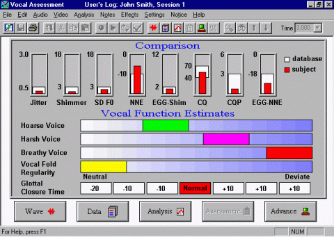 Screenshot of a control panel, with vocal comparison columns on the upper half and function graphs on the lower half.