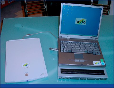 A thin scanner, standard-size scanner connected to a laptop and the optional MobilLine.